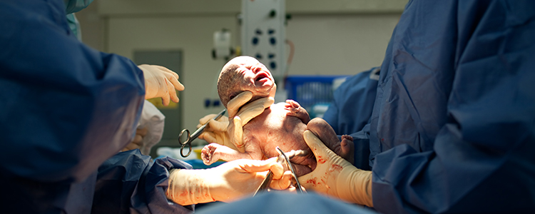 cesarean-section2