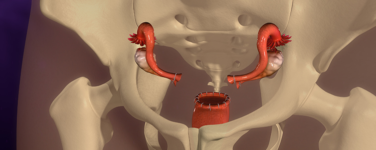 hysterectomy2