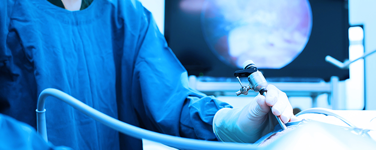 myomectomy2
